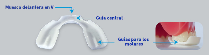 ferula-descarga-bruxismo-clinica-gio-dental - Oralduero