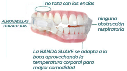 ACWOO Ferula Descarga Bruxismo, 4Pcs Férulas Dentales, Férula Dental  Bruxismo con Caja de Higiene, Protector Bucal Para Dormir, Férula de  Descarga