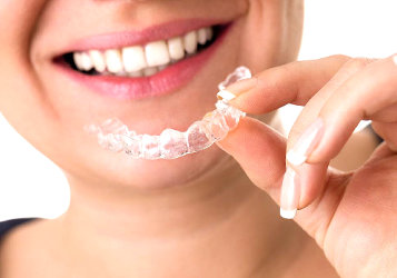 Férula dental moldeable protege implantes y dientes